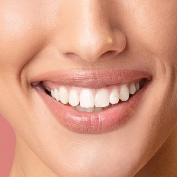 Zoom Teeth Whitening vs. Simple Teeth Whitening: Which Option Works Best for You?