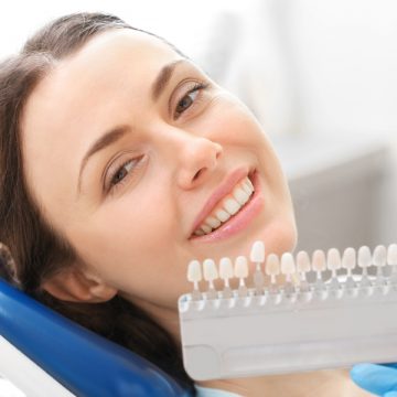 A Detailed Guide to Dental Veneers