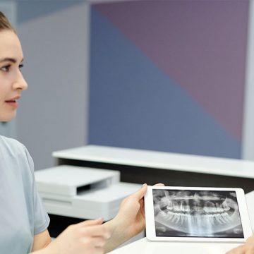 What is the difference between a normal and digital X-ray for teeth?